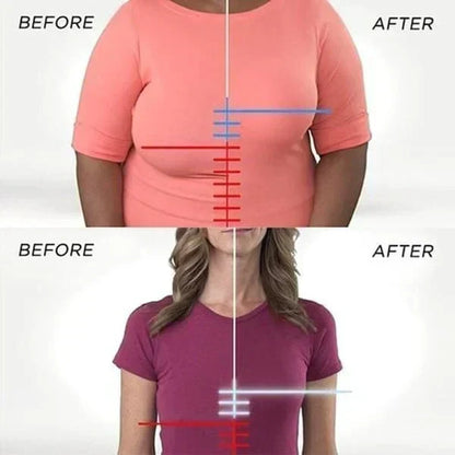 FRONT CLOSURE ACUTEFEBRUARY BRA(BUY 1 FREE 2)